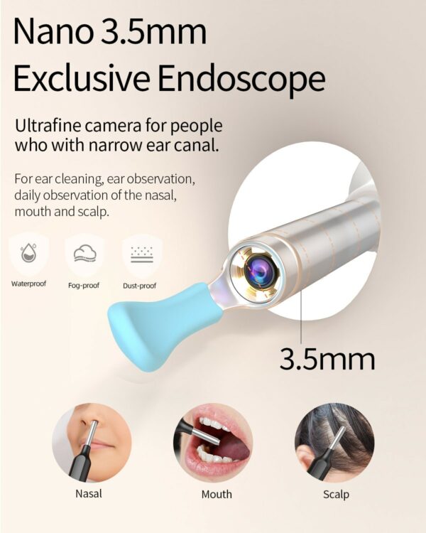 Digital Otoscope - EAR/ BeBird X-1 Digital Ear Canal Camera - Image 3